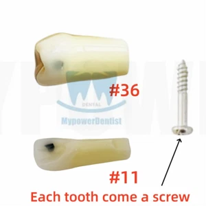 Dental Vitro Teeth Decay Caries Screw Model Dentist Tooth Teach Tool #11 #36 - Picture 1 of 15