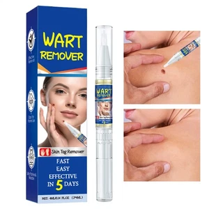 2pcs Schmerzloser Warzenentherover Stift eliminieren Hautmarke Fuß Mais Maulwur - Bild 1 von 9