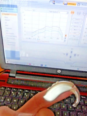 PROGRAMMABLE BEHIND THE EAR  DIGITAL HEARING AID PROFOUND hearing loss  BUY USA - Image 1 of 4