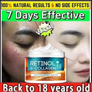 Retinol Cream with Hyaluronic Acid, Day-Night Anti-Aging Moisturizer 30gm - Picture 1 of 10