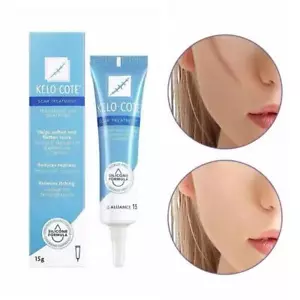 Scar Removal Cream For Repairing Burns and Removing ScarsT - Picture 1 of 10