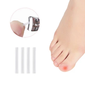 50x Ingrown Toenail Corrector Tool Treatment Elastic Patch Sticker-Straightening - Foto 1 di 13
