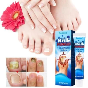 Nail Treatment Fungus Fungal Anti toe Removal Cream CareInfection Solution X8P9 - Picture 1 of 10