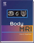 Body MRI Hardcover Evan S. Siegelman