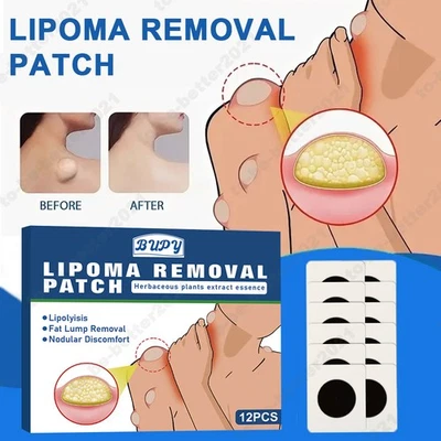 12pcs Lipoma Removal Body Fat Nodule Removal Subcutaneous Nodule Patches - Image 1 of 4