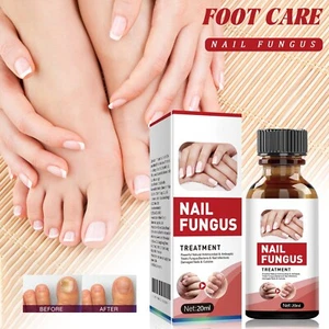 Powerful Nail Serum Nail Care Fast & Advanced For Healthy Nails & Toenails Serum - Picture 1 of 8
