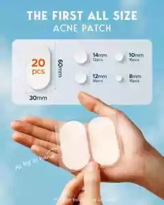 Large Acne Pimple Patches, 5 Sizes 80 Patches for Large Breakouts, Acne Patches - Picture 1 of 3