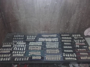 lotto collezione denti antichi - Foto 1 di 1