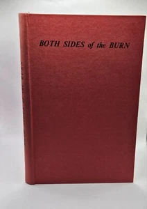 Both Sides Of The Burn The Story Of Yoker 1966 Yoker Secondary School - Imagen 1 de 5