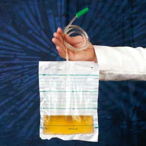 Poche à Urine 1,5 Litre, pour La Bettbefestigung, 90 CM Tuyau - Zdjęcie 1 z 1
