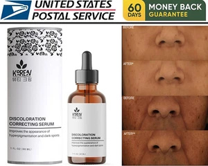 Korean Brightening Face Serum For Pigmentation, Dark Spots & Acne Marks 30ml - Picture 1 of 5