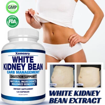 White Kidney Bean- Kohlenhydratblocker, Gewichtsverlust, Verdauungsunterstützung - Bild 1 von 4