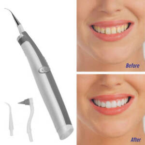 Hot Ultrasonic Vibration Electric Tooth Stain Removal And Whitening Instrument
