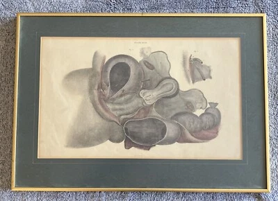 Antique 1823 John Lizars Anatomical Engraving, Plate 94(XCIV) - Image 1 of 4