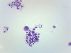 25PK Female Chromosome Smear, Human - Microscope Slides - 75x25mm - Eisco Labs