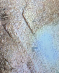1972 D BU Lincoln Memorial Cent Die Clash bars - Picture 1 of 7