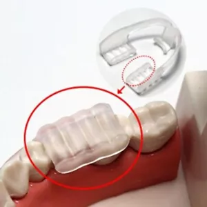 Dental Silicone Mouth Guard Teeth Grinding Protection Clenching Bite Sleep Aid - Picture 1 of 5