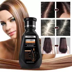Anti Hair Loss Shampoo Natural Ginger Hair Growth Shampoo for Men and Women BEST - Foto 1 di 11