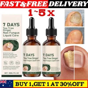 1~5x Ginger Anti-Fungal Nail Treatment Repair Finger Toe Care Nail Fungus Liquid - Picture 1 of 13