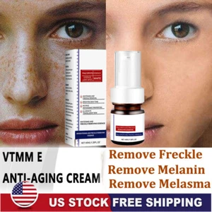 Effective Whitening Freckle Cream Remove Dark Spot Cream Removal Melanin Melasma - Picture 1 of 15