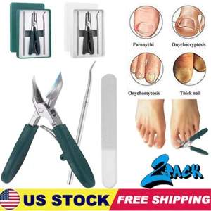 Eagle Beak Nail Clippers,Eagle Beak Beveled Nail Clippers,Sets Of Luxury Eagle - Picture 1 of 23