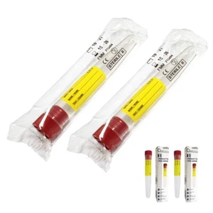 2x provette sterili per analisi urine 12 ml fiale contenitore tappo a pressione - Bild 1 von 7