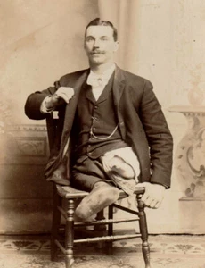 Antique DEFORMED CIRCUS FREAK Rare HUMAN-FROG PHOTO Sideshow Oddity TWISTED BODY - Picture 1 of 6