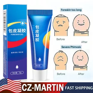 Redundant Prepuce Corrector Gel, Professional Redundant Prepuce Corrector Gel - Picture 1 of 10
