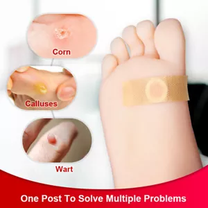 42PCS/Box Corn Patch Corn Plaster Remover Corn Toe Pads Patch Adhesive Callus-v - Picture 1 of 6