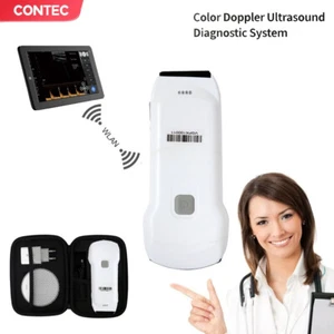 Wifi Wireless 3 In 1 Pocket Ultrasound Cardiac Linear Convex Color Doppler,bag - Picture 1 of 19