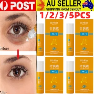 1/5PCS VC Lutein Eye Essence Oil Relieves Eye Fatigue DinKiss Eye Essence Oil - Picture 1 of 16