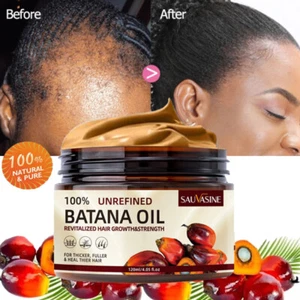 Batana Oil For Hair Growth, Pure Natural Botana Oil Cream Hair Loss Treatment - Picture 1 of 24