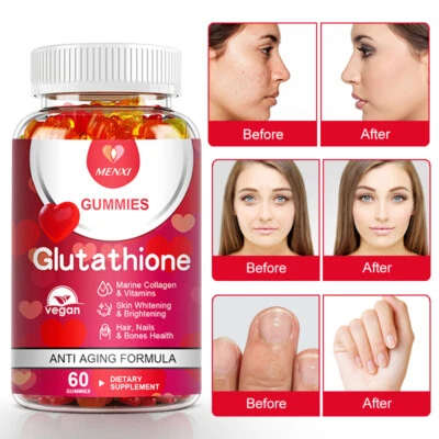 Best Glutathione Skin Whitening Gummies Natural Anti Aging Supplement for Beauty - Image 1 of 4