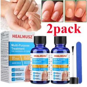 HEALMUSZ Toenail Fungus Treatment for Nail & Fingernails Repair Solution - 30ml - Picture 1 of 17