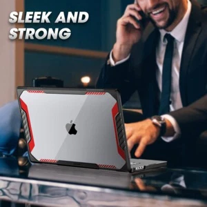 SUPCASE Unicorn for 2021 MacBook Pro 16" Dual Layer Hard Shell Protective Cover - Picture 1 of 37