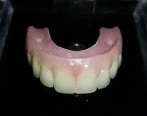 Sin palet implante maxilar modelo dental superior todo en 5 demostrar - Imagen 1 de 7