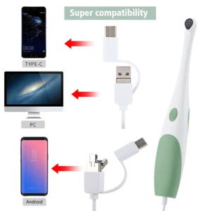 Dental Oral Camera 1080p HD Intraoral Endoscope Adjustable 6 LED Light USB Cable - Picture 1 of 10