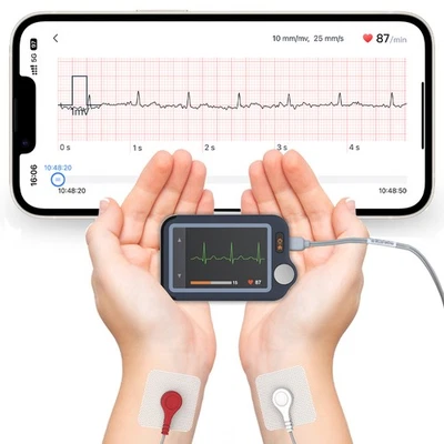 Monitor de ECG para el hogar con cable externo, grabación 30s/60s/5min + análisis de ECG de IA Foto 1 de 4