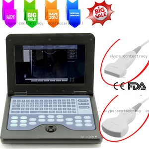 Portable Laptop Machine Digital Ultrasound Scanner 3.5M Convex Probe,7.5M linear - Picture 1 of 12