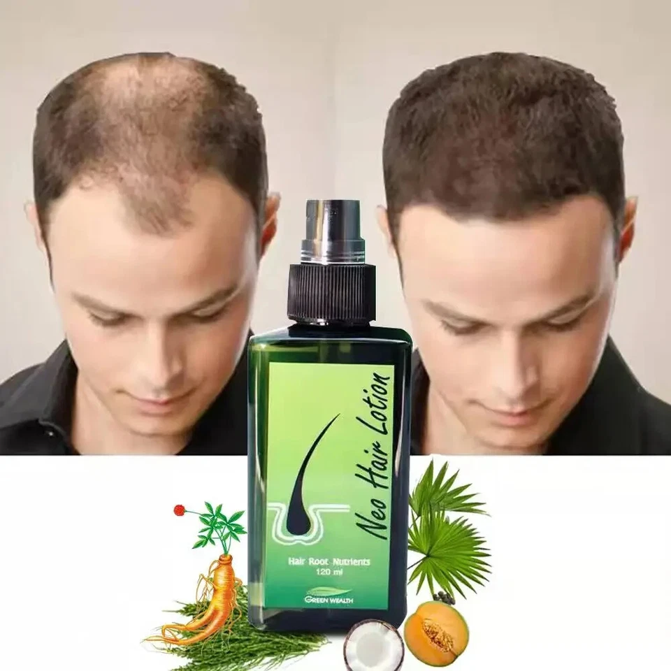3 botellas neo Loción Capilar Green Wealth Tratamiento Crecimiento para Caída del Cabello, Patillas Foto 1 de 4