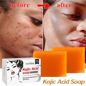 Turmeric Kojic Acid Brightening Soap, Skin Whitening Dark Spots lightening Acne - Picture 1 of 27