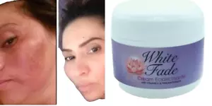 CREMA BLANCA DESVANECIDA; ELIMINA LAS MANCHAS OSCURAS DE LA PIEL, EN SOLO 2 SEMANAS 5oz. - Imagen 1 de 9