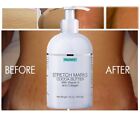  Best Scar Removal-Cream forOld-Scars Stretch Mark Removal Cream for Men & women