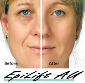 INSTANT LIFT Face & Eye Lifting Anti Wrinkle Serum BEST INSTANT RESULTS EpiLift - Picture 1 of 12