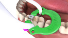 Sectional Matrix System, Dental Rings - Wagotrix Universal Matrix Rings - Qty 35