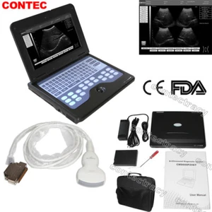 Full Digital B-Ultrasound Scanner 10.1inch Laptop Machine 3.5Mhz Convex Probe,CE - Picture 1 of 12