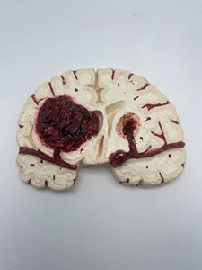 Vintage Gehirnabschnitt Schlaganfall Aneurysma anatomische Pathologie Modell - Bild 1 von 3