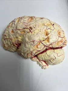 Vintage Brain Anatomical Pathology Model Demonstrating Meningitis - Picture 1 of 3