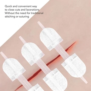 3pcs Emergency Wound Closure Stitches Self Adhesive Wound Closure Devic - Bild 1 von 23