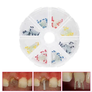 200Pcs Dental Fiber Post Glass Quartz Teeth Restorative 1.0/1.2/1.4/1.6/1.8mm - Picture 1 of 17